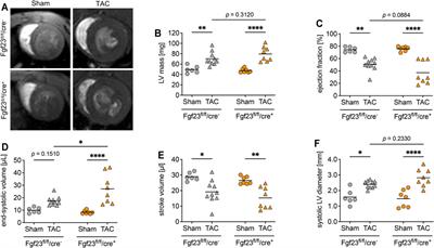 Comprehensive Expression Analysis of Cardiac Fibroblast Growth Factor 23 in Health and Pressure-induced Cardiac Hypertrophy